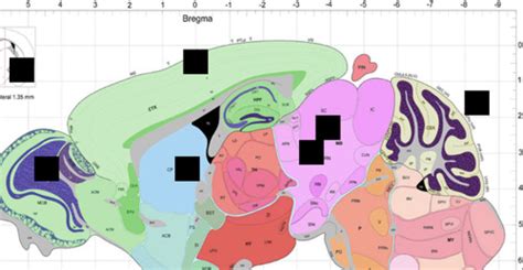 Neuro Exam 1 Flashcards | Quizlet 