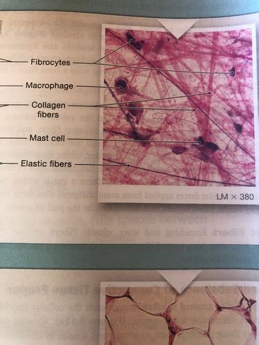 Connective Tissue Flashcards Quizlet