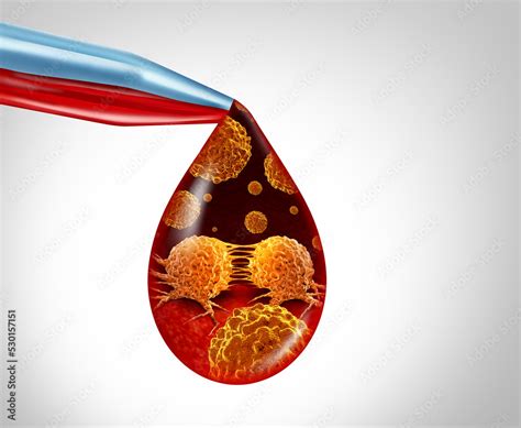 cancer screening  blood test  early detection  malignant cells
