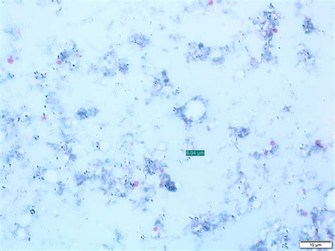 Blastocystis Cyst Black Arrow In Stool Sample Stained With Trichrome Download Scientific