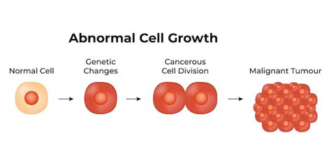 Premium Vector | Abnormal cell growth normal cell genetic changes ...