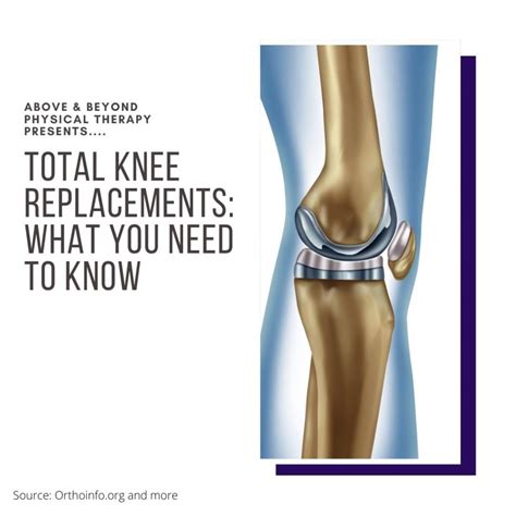 Total Knee Replacement Rehab Fact Sheet Series Above Beyond