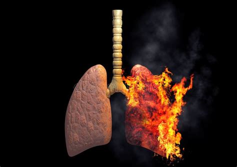 Smoker S Lungs On Fire From Excessive Use Of Cigarettes Concept Of