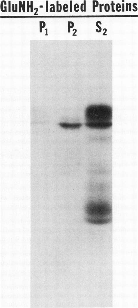 Autoradiogram Of An Sds Acrylamide Gel Slab Showing The Electrophoretic