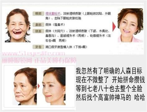 [中国]70歳のおばあちゃん、整形後の画像 ポッカキット