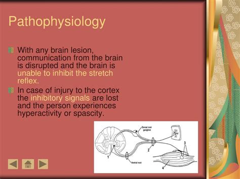 Ppt Spasticity In Cerebral Palsy Pathophysiology To Practice