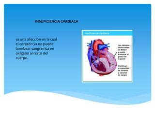 Insuficiencia Cardiaca Ppt