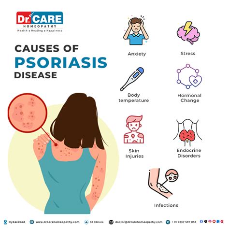 Psoriasis - Types, Symptoms, Causes, Complications And Treatment