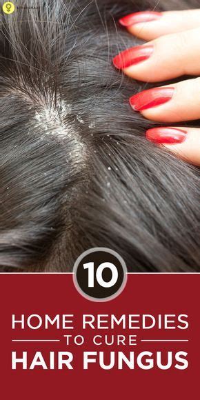 10 Scalp fungus treatment ideas | scalp fungus treatment, home remedies, remedies