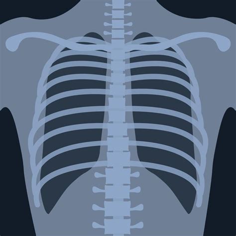 radiografía de tórax en posición vertical para la investigación médica ...