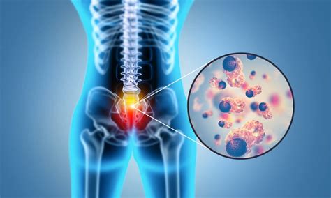 Learn Everything About Lumbar Disc Degeneration Pathology - El Paso, TX ...