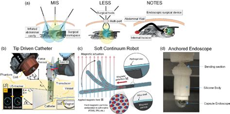 Examples Of Magnetically Controlled Soft Robotics In Endovascular And