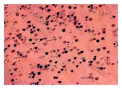 Alkaline Phosphatase Ap Staining Showed The Pluripotency In Embryonic