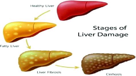 Normal Stages Of Liver Damage Download Scientific Diagram