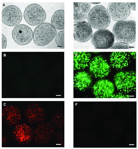 Representative fluorescence microscopy image with calcein-AM and ...