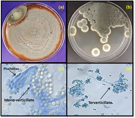 Penicillium Fungi Microscope