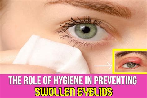 Swollen Eyelids Prevention: The Role Of Good Hygiene