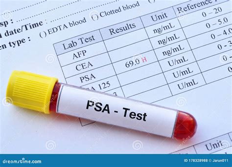 Abnormal High Psa Test Result Stock Photo Image Of Hematology