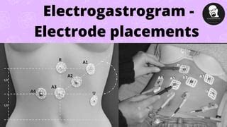 Electrogastrogram basics | PPT