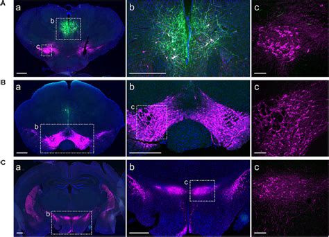 ChR2 EYFP Expression Is Restricted To A11 Area Immunohistochemistry