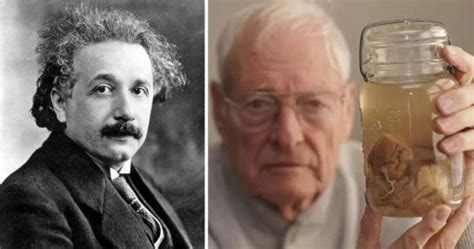 Doctorul Care I A Furat Creierul Lui Albert Einstein Thomas Harvey