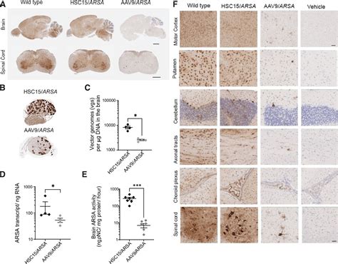 Single Systemic Administration Of A Gene Therapy Leading To Disease