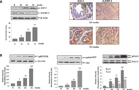 Expression Of Igf I Igfbp Pi K Akt And Erk In The