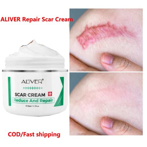 ALIVER Scar Repair Cream Remove Acne Scar Remover Stretch Mark Scald