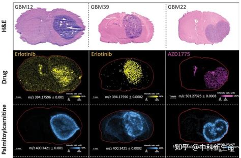 肿瘤空间代谢组学专题 线上研讨会热点问题解答及经典案例分享 知乎