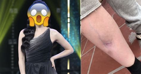 Hot Girl Ng I Y L Ai G P Bi N Ch Ng Th M M Ch N Teo C Gi N T Nh M Ch Nghi M Tr Ng Gi Ra Sao