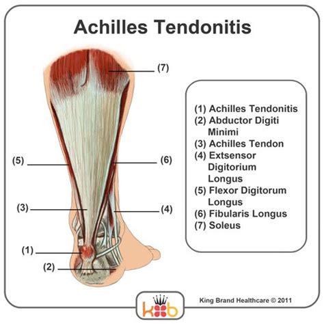 Achilles Tendon Anatomy Diagram