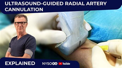 Ultrasound Guided Radial Artery Cannulation Crash Course With Dr Hadzic Youtube