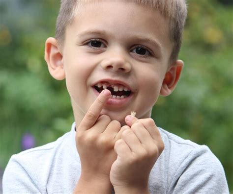 A Criança Perdeu Um Dente Foco Seletivo Conceito De Dente De Leite