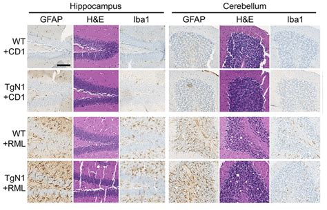 Immunohistochemical Assessment Of Spongiosis And Glial Activation In