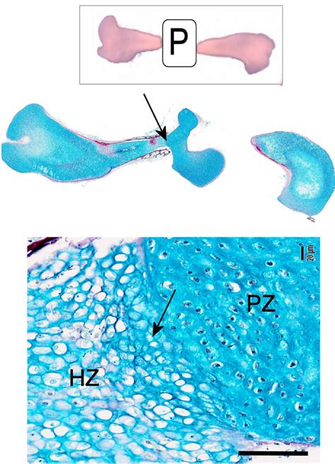 Directional Cues In Chick Growth Plate Regions Implantation Of