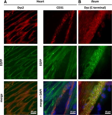 Dystrophin Egfp Expression In Heart And Smooth Muscle A Colocalization