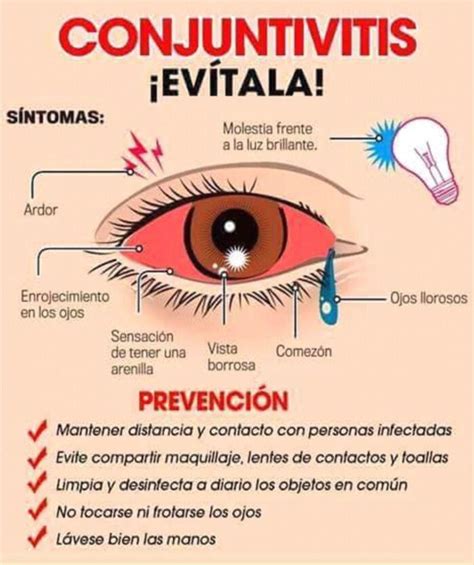 Se Incrementan Los Casos De Conjuntivitis Virósica