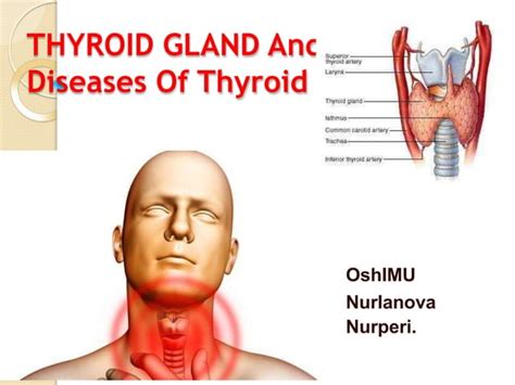 Diseases Of Thyroid Gland Pptx