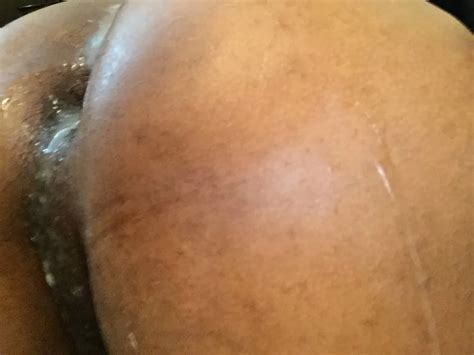 Anal Gape 28 Nude Pics XHamster