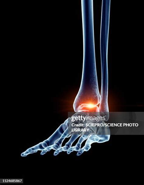 ankle bone   premium high res pictures getty images