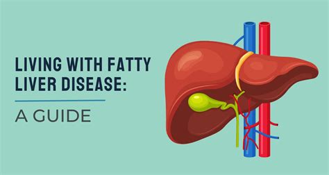 Living With Fatty Liver Disease: A Guide – Ingredient Fact