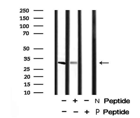 Phospho Bcl Thr Polyclonal Antibody Invitrogen L