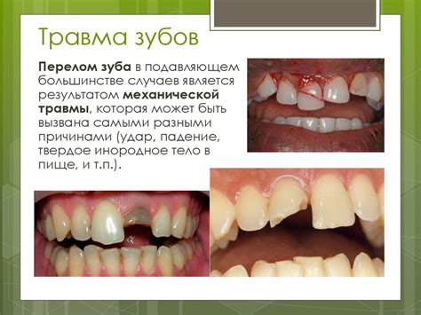 Профилактика стоматологических заболеваний - презентация онлайн