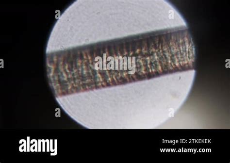 Human Hair Under A Microscope Microscopy Of A Single Human Hair From