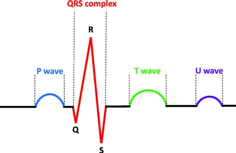 Ecg Waveform Explained Ekg Labeled Diagrams And Components