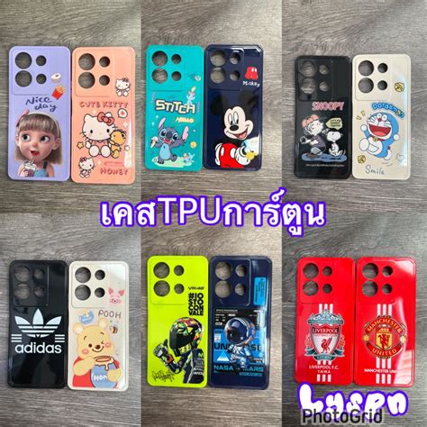 เคสTPUลายการตนนารก สำหรบInfinix Note g Note g Hot g เคสนมลายการตน สามารถ