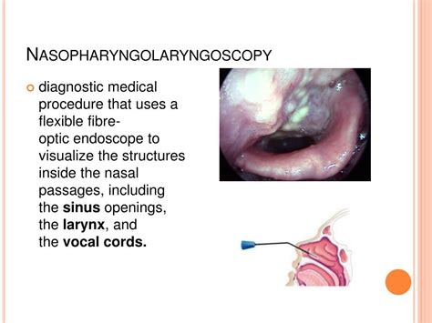 Ppt Oral Cavity Mass Powerpoint Presentation Free Download Id 535469