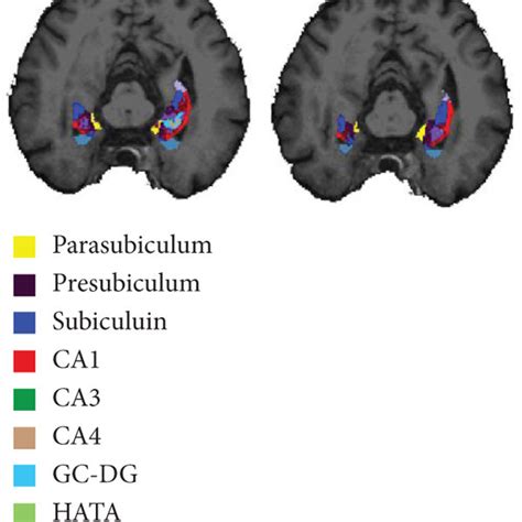 Segmentation Template Of The Hippocampus And Amygdala Download