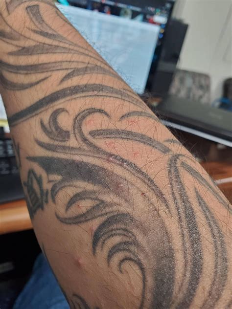 Red blister bumps on arm | Scrolller