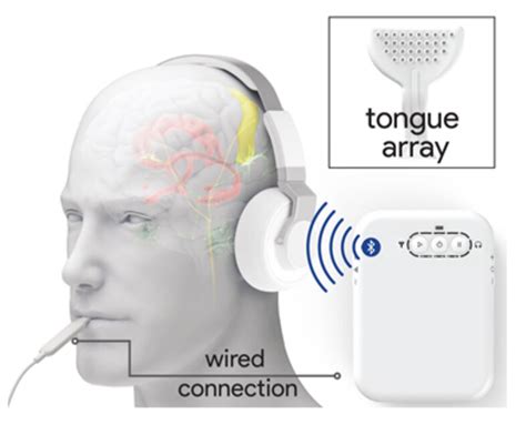 sehen betrunken Luxus tinnitus noise cancelling kopfhörer Zeigen cool Stein